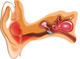 Зовнішній отит